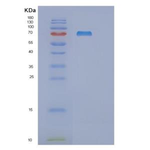 Recombinant Human RNGTT Protein,Recombinant Human RNGTT Protein