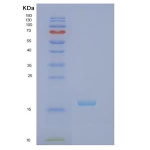 Recombinant Human RBP7 Protein,Recombinant Human RBP7 Protein