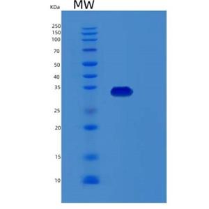 Recombinant Human RDH12 Protein