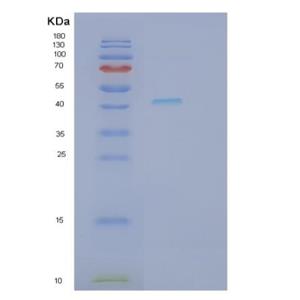 Recombinant Human REN Protein,Recombinant Human REN Protein