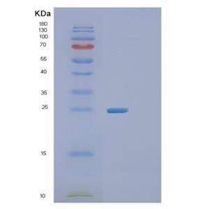 Recombinant Human RGS16 Protein,Recombinant Human RGS16 Protein