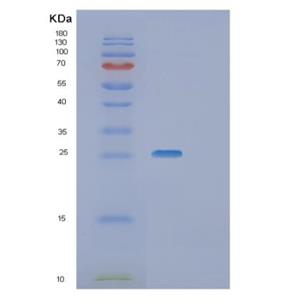 Recombinant Human RGS4 Protein
