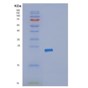 Recombinant Human RPL11 Protein,Recombinant Human RPL11 Protein