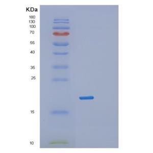 Recombinant Human RPL12 Protein,Recombinant Human RPL12 Protein