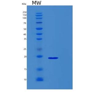 Recombinant Human RPL26 Protein,Recombinant Human RPL26 Protein