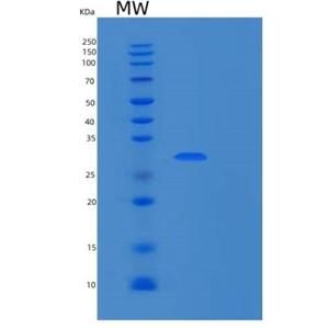 Recombinant Human RPP30 Protein,Recombinant Human RPP30 Protein