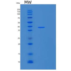 Recombinant Human RPRD1A Protein,Recombinant Human RPRD1A Protein