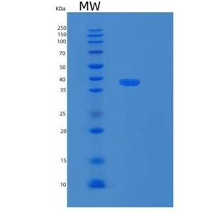 Recombinant Human RPRD1B Protein