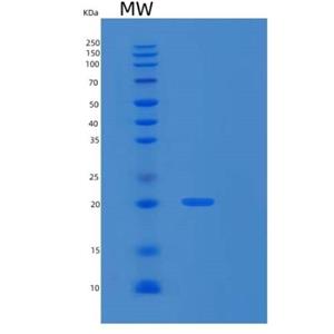 Recombinant Human RPS10 Protein,Recombinant Human RPS10 Protein