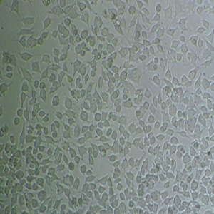 MuM-2B人侵袭性脉络膜黑色素瘤细胞,MuM-2B