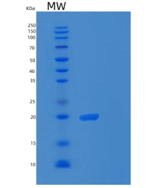 Recombinant Human RPS18 Protein,Recombinant Human RPS18 Protein