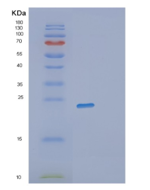 Recombinant Human RWDD4 Protein,Recombinant Human RWDD4 Protein