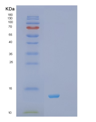 Recombinant Human RXR-α( Retinoid x receptor) Protein,Recombinant Human RXR-α( Retinoid x receptor) Protein