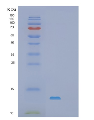 Recombinant Mouse S100A1 Protein,Recombinant Mouse S100A1 Protein