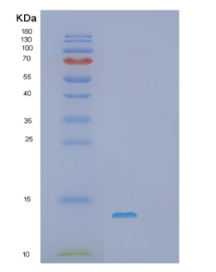 Recombinant Human S100A10 Protein,Recombinant Human S100A10 Protein