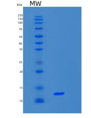 Recombinant Human S100A16 Protein,Recombinant Human S100A16 Protein