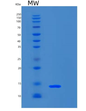 Recombinant Human S100A4 Protein,Recombinant Human S100A4 Protein