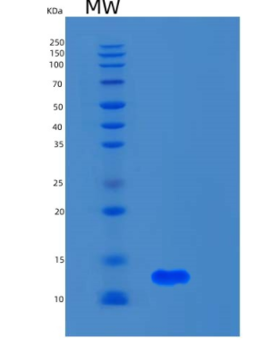 Recombinant Human S100A5 Protein,Recombinant Human S100A5 Protein