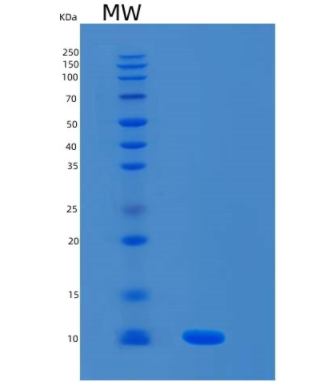 Recombinant Human S100A8 Protein,Recombinant Human S100A8 Protein