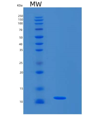 Recombinant Mouse S100A8 Protein,Recombinant Mouse S100A8 Protein