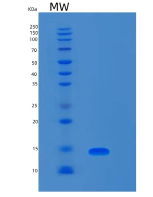 Recombinant Human S100A8-Myc Protein,Recombinant Human S100A8-Myc Protein