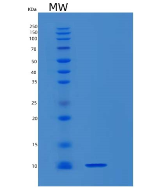 Recombinant Mouse S100b Protein,Recombinant Mouse S100b Protein