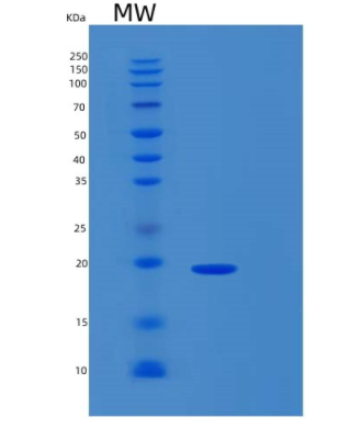 Recombinant Human SAP18 Protein,Recombinant Human SAP18 Protein