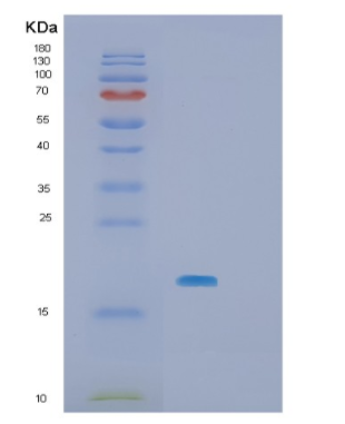 Recombinant Human SBDS Protein,Recombinant Human SBDS Protein