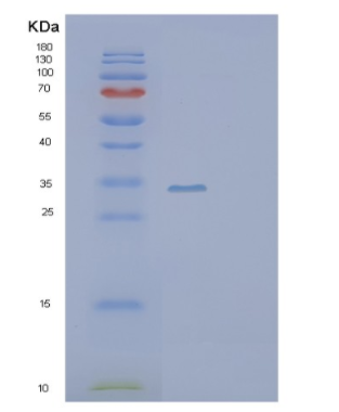 Recombinant Human SCGN Protein,Recombinant Human SCGN Protein