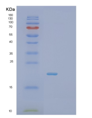 Recombinant Human SCO1 Protein,Recombinant Human SCO1 Protein