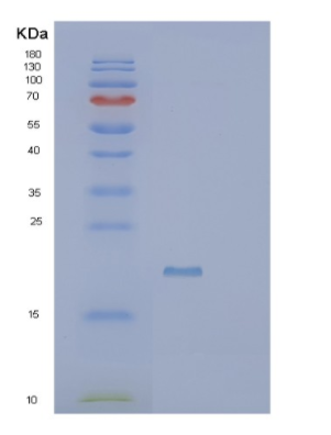 Recombinant Human SCP2D1 Protein,Recombinant Human SCP2D1 Protein