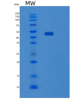 Recombinant Human SCRN1 Protein,Recombinant Human SCRN1 Protein