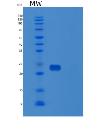 Recombinant Human SDF2 Protein,Recombinant Human SDF2 Protein