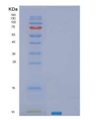 Recombinant Human SEC61B Protein,Recombinant Human SEC61B Protein