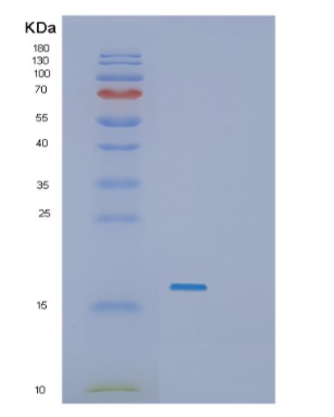 Recombinant E.coli SecB Protein,Recombinant E.coli SecB Protein