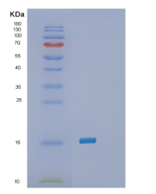 Recombinant Human SELH(SC44C) Protein,Recombinant Human SELH(SC44C) Protein