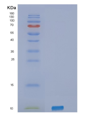 Recombinant Human SELPLG Protein,Recombinant Human SELPLG Protein