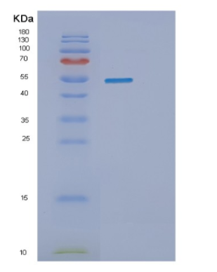 Recombinant Human SEMG1 Protein,Recombinant Human SEMG1 Protein