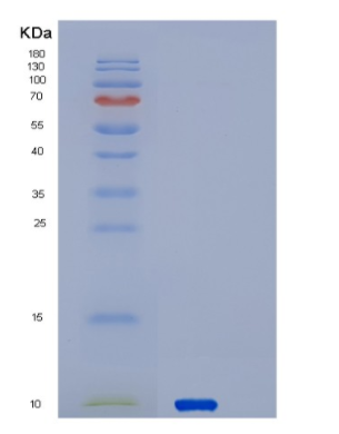 Recombinant Human SERF2 Protein,Recombinant Human SERF2 Protein