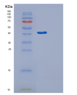 Recombinant Human Serpin A5 Protein,Recombinant Human Serpin A5 Protein