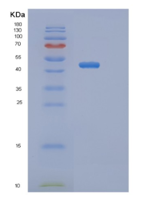 Recombinant Mouse Serpina9 Protein,Recombinant Mouse Serpina9 Protein