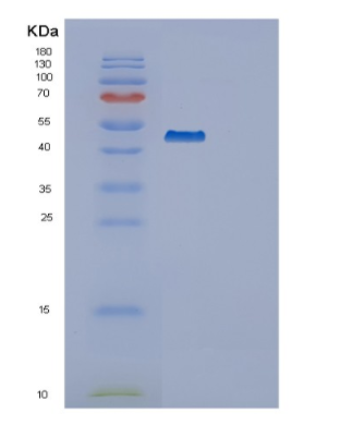 Recombinant Human SERPINB3 Protein,Recombinant Human SERPINB3 Protein