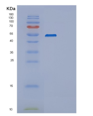 Recombinant Human SERPINB4 Protein,Recombinant Human SERPINB4 Protein