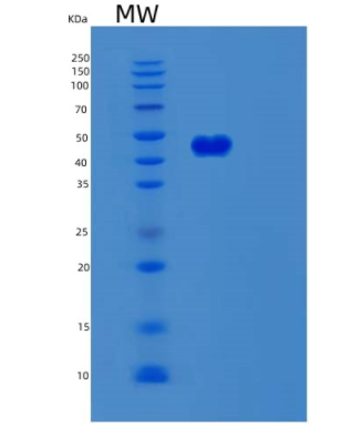 Recombinant Human SERPINB8 Protein,Recombinant Human SERPINB8 Protein