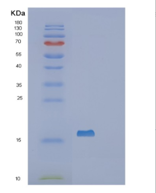 Recombinant Human SF3B14 Protein,Recombinant Human SF3B14 Protein