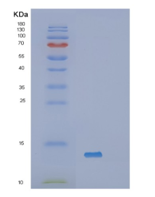Recombinant Human Serum Amyloid A Protein,Recombinant Human Serum Amyloid A Protein