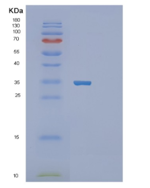 Recombinant Human SFRP2 Protein,Recombinant Human SFRP2 Protein