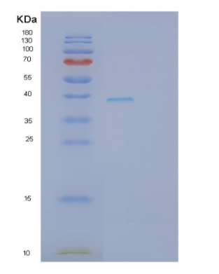Recombinant Human SFRP4 Protein,Recombinant Human SFRP4 Protein