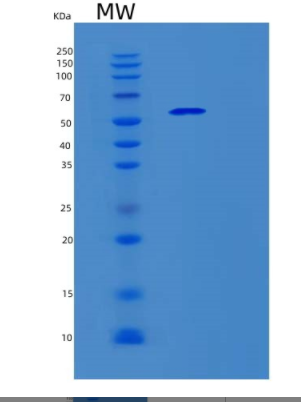 Recombinant Human SERPING1 Protein,Recombinant Human SERPING1 Protein