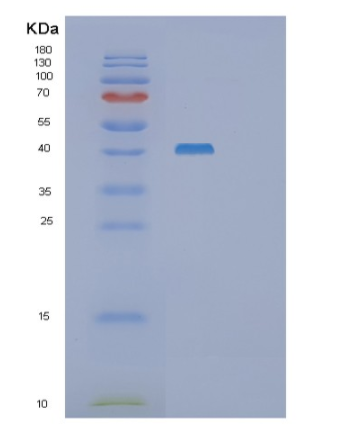 Recombinant Human SET7/9 Histone methyltransferase Protein,Recombinant Human SET7/9 Histone methyltransferase Protein